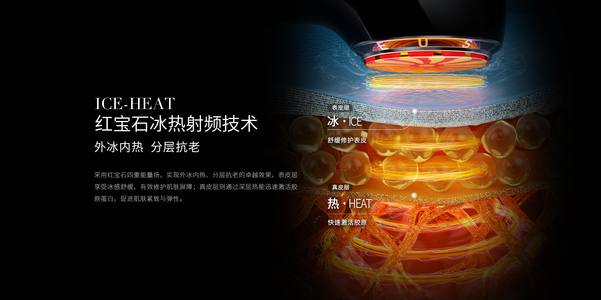ICE-HEAT红宝石冰热射频技术